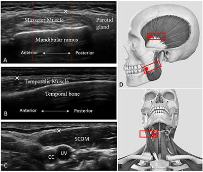 Ultrasound Imaging of Head/Neck Muscles and Their Fasciae: An Observational Study
